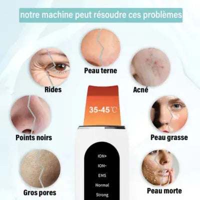 ÉPURATEUR DE PEAU À ULTRASONS - POINT NOIR I ULTRACLEAR™